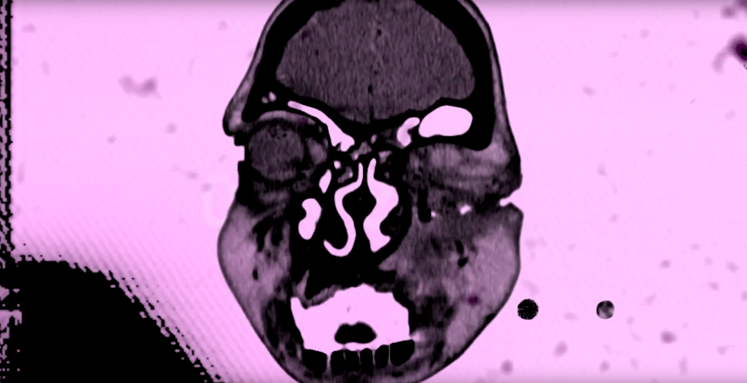 Photo of set Kahn & Neek: 'Venus'.